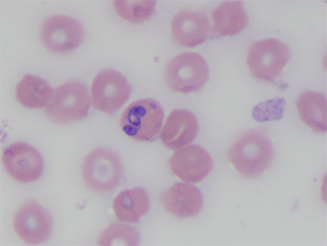 blood smear